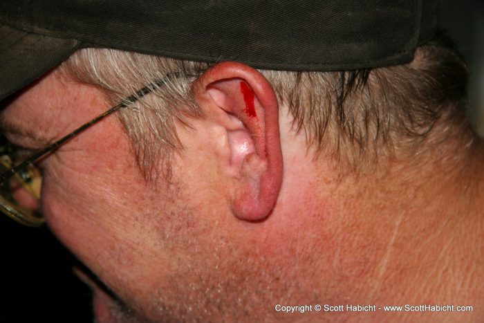 And his ear was bleeding from it.